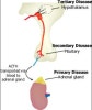 secondary adrenal insufficiency