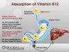 활성형 비타민 B12(methylcobalamin) – 뇌 노화 예방과 뇌 기능 건강 유지 및 강화 : 네이버 블로그